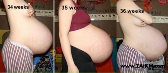 图说女性怀孕周期[图3]
